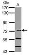 NFKB Inhibitor Zeta antibody, GTX116752, GeneTex, Western Blot image 