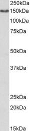 C-type lectin domain family 12 member A antibody, 43-576, ProSci, Western Blot image 