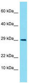 LIM Zinc Finger Domain Containing 3 antibody, TA337410, Origene, Western Blot image 