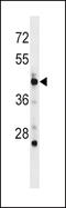 DNA Polymerase Delta 3, Accessory Subunit antibody, 58-435, ProSci, Western Blot image 
