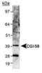 Abhydrolase Domain Containing 5 antibody, TA301522, Origene, Western Blot image 