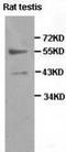 Peroxisome proliferator-activated receptor gamma antibody, TA310124, Origene, Western Blot image 