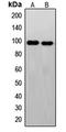 FER Tyrosine Kinase antibody, LS-C352193, Lifespan Biosciences, Western Blot image 