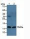 Fatty Acid Binding Protein 3 antibody, LS-C723357, Lifespan Biosciences, Western Blot image 
