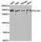 Phospholipase C Gamma 2 antibody, TA327320, Origene, Western Blot image 