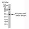 Putative virulence-regulating 38 kDa protein antibody, 0100-0519, Bio-Rad (formerly AbD Serotec) , Western Blot image 