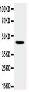 Mitogen-Activated Protein Kinase 8 antibody, PA1892, Boster Biological Technology, Western Blot image 
