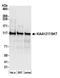 Sickle tail protein antibody, A304-928A, Bethyl Labs, Western Blot image 