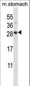 Dolichyldiphosphatase 1 antibody, LS-C167505, Lifespan Biosciences, Western Blot image 