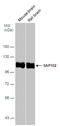 DLG3 antibody, GTX133211, GeneTex, Western Blot image 