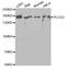 Phospholipase C Gamma 2 antibody, STJ25024, St John