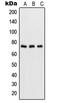 p65 antibody, LS-C352793, Lifespan Biosciences, Western Blot image 
