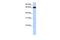 Zinc Finger Protein 14 antibody, GTX45849, GeneTex, Western Blot image 