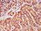 Developmental pluripotency-associated 5 protein antibody, CSB-PA007147LA01HU, Cusabio, Immunohistochemistry paraffin image 