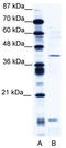 CAMP Responsive Element Modulator antibody, TA337721, Origene, Western Blot image 