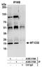 Mitochondrially Encoded Cytochrome C Oxidase II antibody, A305-319A, Bethyl Labs, Immunoprecipitation image 