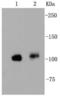 Protein Tyrosine Kinase 2 antibody, NBP2-67327, Novus Biologicals, Western Blot image 