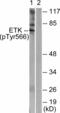 BMX Non-Receptor Tyrosine Kinase antibody, A02537Y566, Boster Biological Technology, Western Blot image 