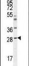 Amyloid P Component, Serum antibody, PA5-24171, Invitrogen Antibodies, Western Blot image 