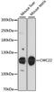 Pre-mRNA-splicing factor CWC22 homolog antibody, GTX66164, GeneTex, Western Blot image 