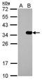 S-tag epitope tag antibody, GTX628791, GeneTex, Western Blot image 