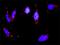 PKACA antibody, H00005566-M02, Novus Biologicals, Proximity Ligation Assay image 