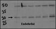DSC1 antibody, F40134-0.4ML, NSJ Bioreagents, Western Blot image 