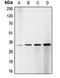 Cyclin Dependent Kinase 1 antibody, orb213710, Biorbyt, Western Blot image 