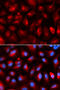 KLC1 antibody, A04116, Boster Biological Technology, Western Blot image 