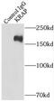 ITPR Interacting Domain Containing 2 antibody, FNab04640, FineTest, Immunoprecipitation image 