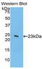 Spectrin alpha chain, brain antibody, LS-C292780, Lifespan Biosciences, Western Blot image 
