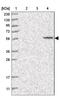Solute Carrier Family 43 Member 3 antibody, NBP1-85026, Novus Biologicals, Western Blot image 