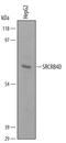 Scavenger Receptor Cysteine Rich Family Member With 4 Domains antibody, PA5-47761, Invitrogen Antibodies, Western Blot image 