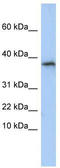 GLYAT antibody, TA346745, Origene, Western Blot image 