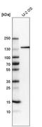 5-azacytidine-induced protein 1 antibody, HPA024019, Atlas Antibodies, Western Blot image 