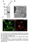 mCherry Tag  antibody, AB0081-200, SICGEN, Electron Microscopy image 