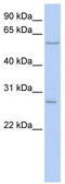 Neuropilin and tolloid-like protein 2 antibody, TA342354, Origene, Western Blot image 