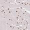 Ripply Transcriptional Repressor 3 antibody, PA5-63139, Invitrogen Antibodies, Immunohistochemistry paraffin image 