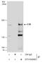 ERCC Excision Repair 6, Chromatin Remodeling Factor antibody, GTX104589, GeneTex, Immunoprecipitation image 