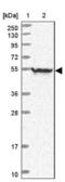 Neuronal Differentiation 4 antibody, NBP2-13932, Novus Biologicals, Western Blot image 