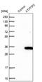 HIV-1 Tat Interactive Protein 2 antibody, NBP1-88170, Novus Biologicals, Western Blot image 