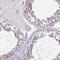 DDX39A antibody, HPA055334, Atlas Antibodies, Immunohistochemistry frozen image 