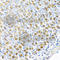 Ferrochelatase, mitochondrial antibody, A8418, ABclonal Technology, Immunohistochemistry paraffin image 