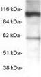 Coatomer Protein Complex Subunit Beta 1 antibody, ab2899, Abcam, Western Blot image 