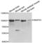 Synaptosome Associated Protein 91 antibody, PA5-77012, Invitrogen Antibodies, Western Blot image 