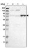 Ectonucleoside Triphosphate Diphosphohydrolase 4 antibody, PA5-53619, Invitrogen Antibodies, Western Blot image 