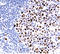 MutL Homolog 1 antibody, DM430, Origene, Immunohistochemistry paraffin image 