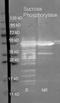Putative sucrose phosphorylase antibody, R1150PS, Origene, Western Blot image 