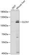 Chloride Voltage-Gated Channel 1 antibody, 19-827, ProSci, Western Blot image 