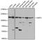 Spliceosome Associated Factor 1, Recruiter Of U4/U6.U5 Tri-SnRNP antibody, A8569, ABclonal Technology, Western Blot image 